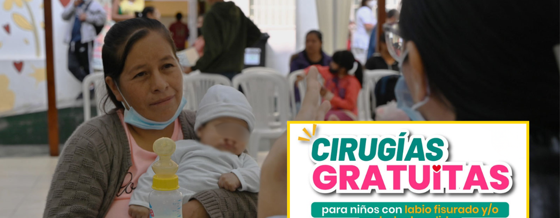 INSN Breña anuncia cirugías gratuitas para niños con labio fisurado y paladar hendido