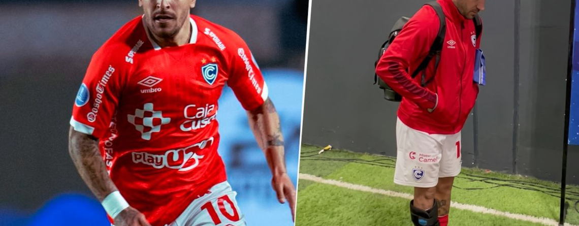 Hohberg enciende la preocupación en Cienciano antes de la revancha en Montevideo